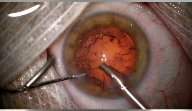 Photo from the movie The Fabric of the Human Body