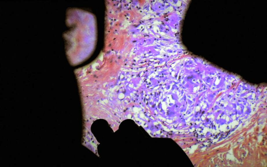 Photo from the movie The Fabric of the Human Body